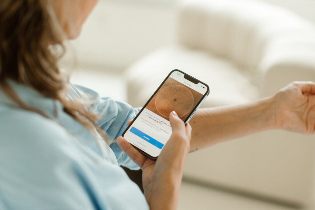 Nieuw! SkinVision voor iedereen met een Care4Life basisverzekering